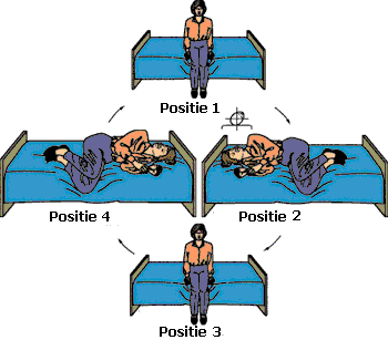 Brandt-Daroff oefeningen